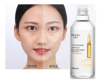 خرید تونر آمپول نیکوتینامید300ml