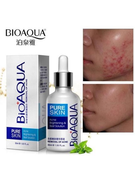 خرید سرم درمان جای جوش و اسکار بیوآکوا 30ml
