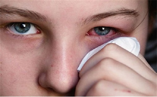 بروز واکنش‌ های پوستی و حساسیت