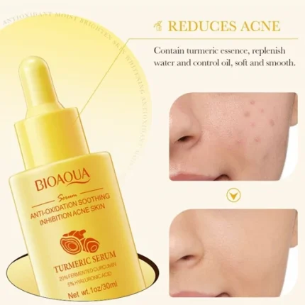 سرم صورت زردچوبه بیوآکوا 30 میل